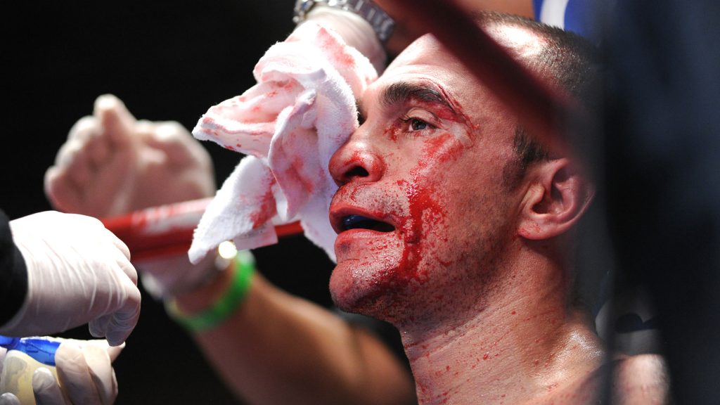 A bloodied Israel Villela returns to his corner to be cleaned up during his fight with Anthony Marsella Jr.